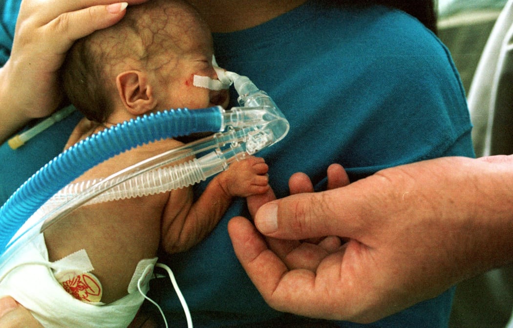 A premature infant.