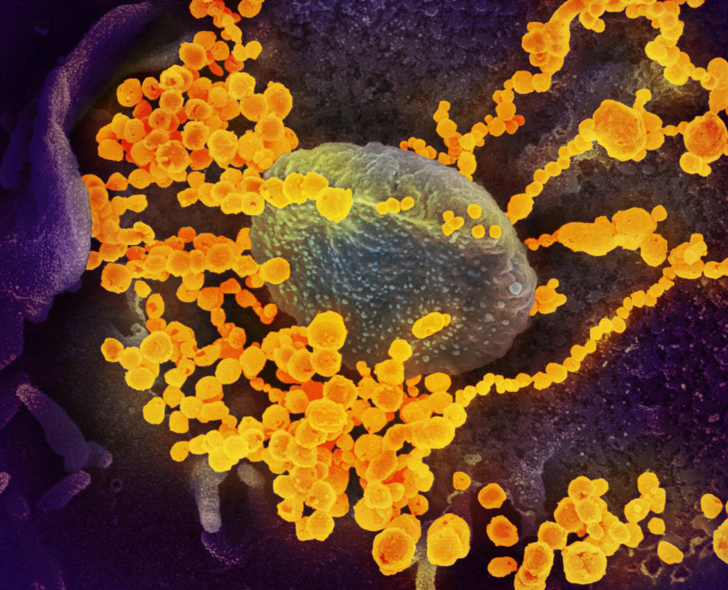 Novel Coronavirus SARS-CoV-2 ; This scanning electron microscope image shows SARS-CoV-2 (round gold objects) emerging from the surface of cells cultured in the lab. SARS-CoV-2, also known as 2019-nCoV, is the virus that causes COVID-19. The virus shown was isolated from a patient in the U.S.
