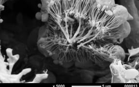 Choanocyte Chamber