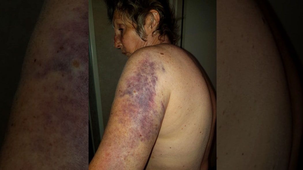 Marlborough woman Sandie Wooster has had to cancel plans to spend Christmas in Christchurch after a slip in Blenheim’s town centre left her unable to walk