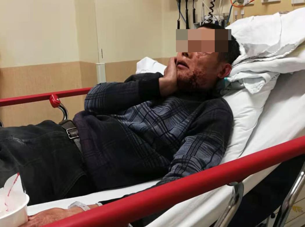 Renkun Li in hospital after he was attacked.