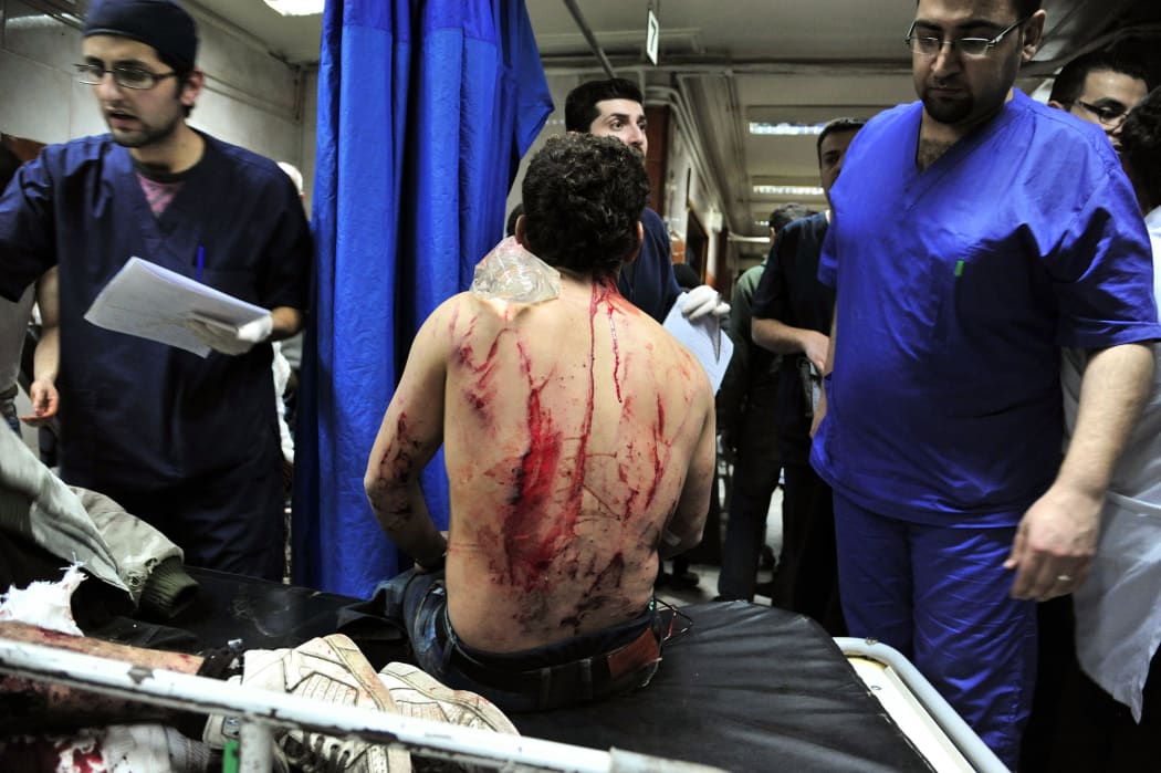 A wounded a Syrian receiving treatment at a hospital in the Syrian capital Damascus following bomb blasts.