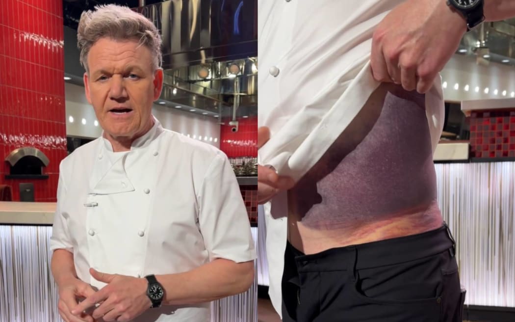 Gordon Ramsay - Figure 1