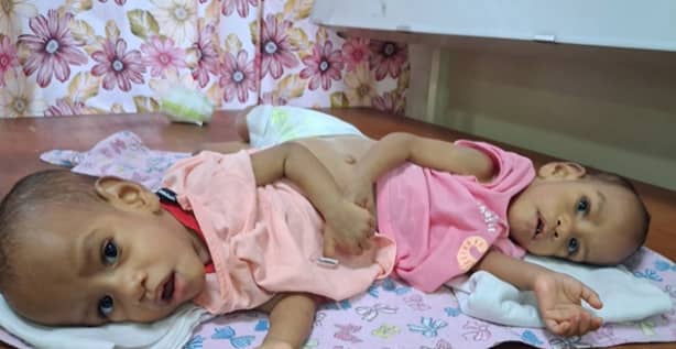The Saudi Arabia government has fully funded their entire trip, covering airfares and accommodation for the triplets and their parents.