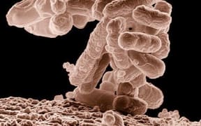 Low-temperature electron micrograph of a cluster of E. coli bacteria, magnified 10,000 times. Each individual bacterium is oblong shaped.(