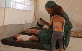 A displaced Palestinian girl, who according to doctors is suffering from chickenpox, stands next to her mother inside the family's tent in Khan Yunis, in the southern Gaza Strip, on July 19, 2026. Doctors and displaced families in Gaza say the highly contagious disease has surged in recent months as war has forced hundreds of thousands of Palestinians into cramped tent camps with no clean water for hygiene. UNICEF said health officials had already recorded more than 9,300 suspected cases of chickenpox across Gaza in early July, concentrated mainly in Khan Yunis in the south. (Photo by Bashar Taleb / AFP)