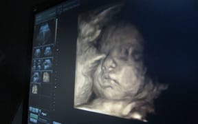 Baby Good 3d Ultrasound
