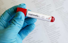 Legionnaires' disease test sample.