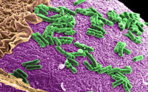 Microbes in a slice of a biofilm.