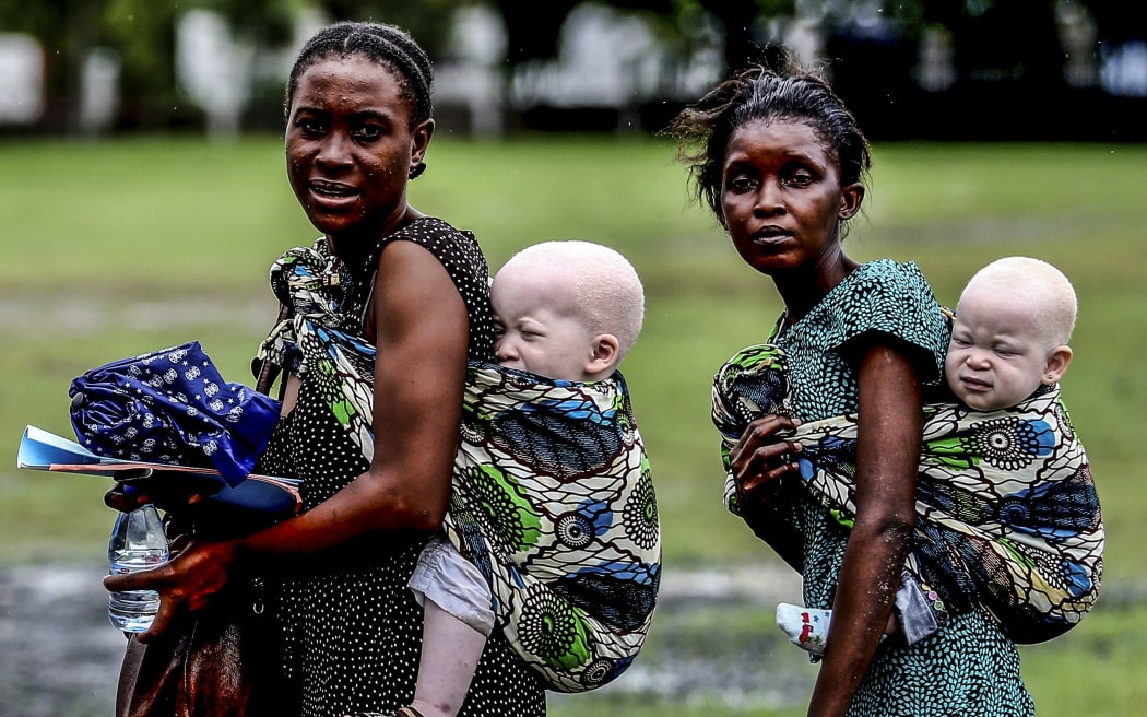 Women carrying their albino children on May 5, 2014, Tanzania.