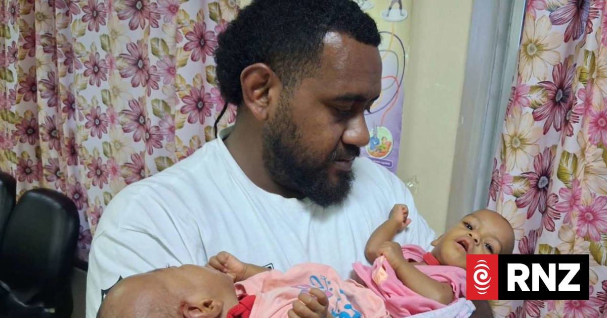 Three countries asked for US$1 million. Then Saudi Arabia stepped in to offer free surgery for Fiji's rare conjoined twins