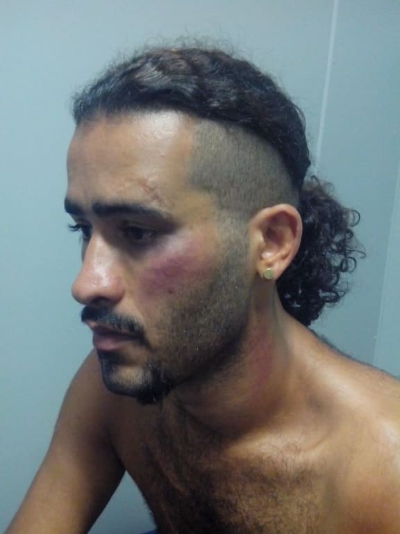 Iranian asylum seeker on Manus