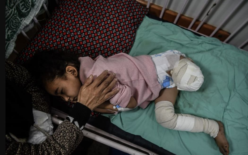 Four-year-old Ghazal's foot was amputated after her house in Gaza City was besieged by military tanks in October, 2023.
