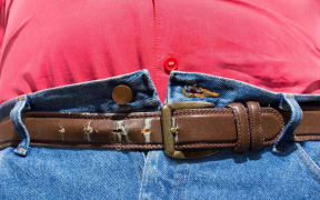 Obesity
