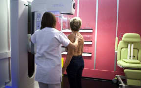 breast screening