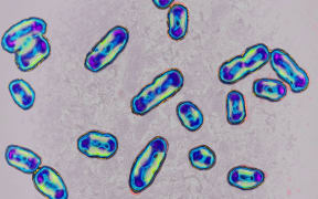 Plague is caused by the bacteria Yersinia pestis and is spread to humans through infected flea bites or contact with infected animals.