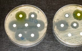 Antibiotic resistance