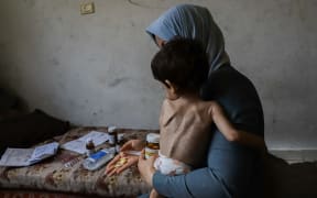 Mother of the 3-year-old child Amjed Al-Qanooa, who suffers from severe malnutrition, shows the pills prescribed for her son in the Jabalia Camp in northern Gaza on June 9, 2024. Al-Qanooa, who suffers from severe malnutrition, weighs 5 kg, and signs of malnutrition are visible on his body and face. Palestinian children are increasingly suffering from severe malnutrition and dehydration amid Israeli attacks on the densely populated Gaza Strip. (Photo by Abood Abusalama / Middle East Images / Middle East Images via AFP)