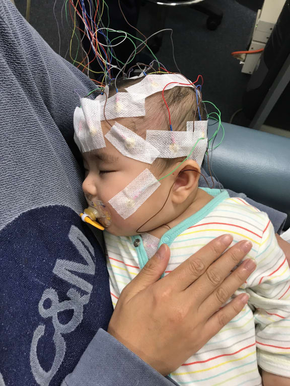 Catherine, baby with rare form of cancer and brain abnormality