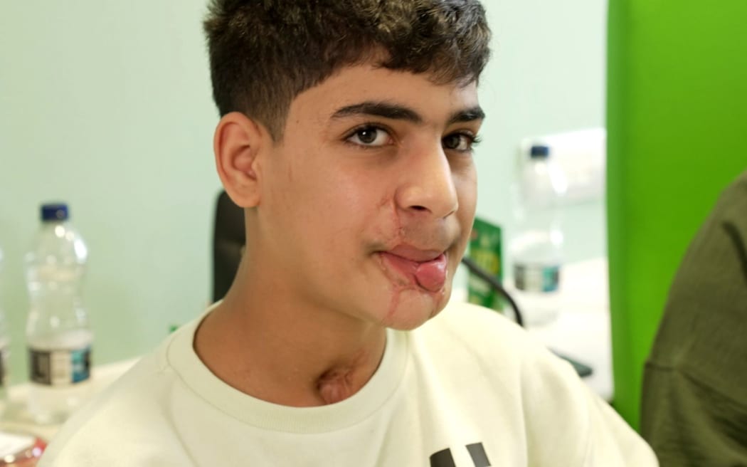 Teenager Majd Alshaghnobi was believed to be dead.