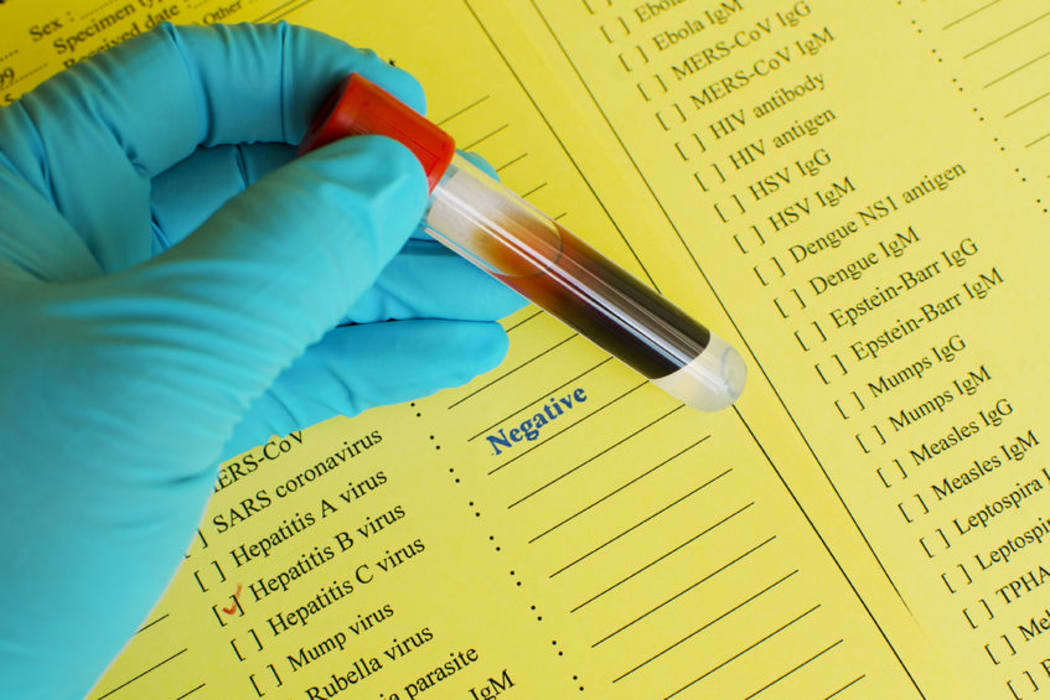 The Hepatitis Foundation and a trust linked to it are being investigated by Charities Services.