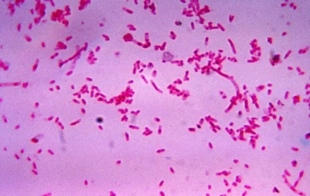 Fusobacterium novum in culture