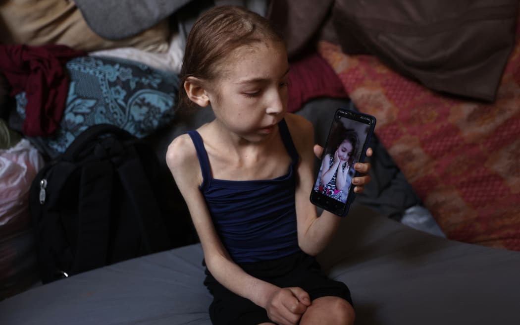 Rahaf Ayyad, a 12-year-old Palestinian who is suffering from malnutrition, shows off an old picture of her as she sits at a school-turned-shelter in al-Rimal in central Gaza City on May 4, 2025. Amnesty International accused Israel on April 29, of committing a "live-streamed genocide" against Palestinians by forcibly displacing Gazans and creating a humanitarian catastrophe in the besieged territory, claims Israel dismissed as "blatant lies". (Photo by Omar AL-QATTAA / AFP)