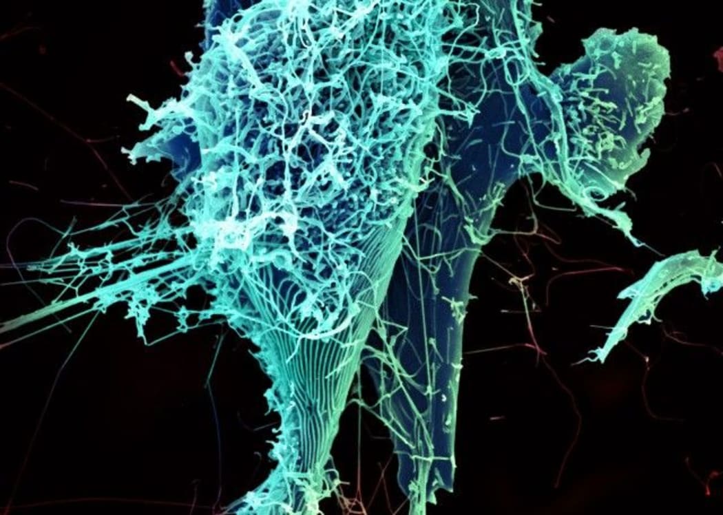 String-like Ebola virus particles are shedding from an infected cell in this electron micrograph.
