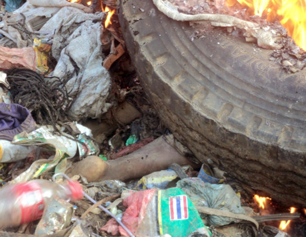 Close up photo of the foot of a young mother under burning tires taken on February 6, 2013 in Mount Hagen city in the Western Highlands of Papua New Guinea.