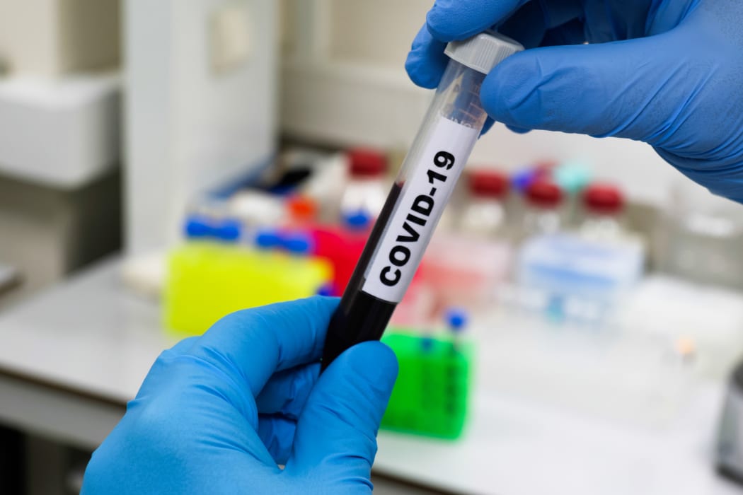 Blood test for COVID-19. Examination of a blood sample for the presence of SARS-CoV-2 coronavirus.