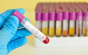 Testing for sexually transmitted diseases.