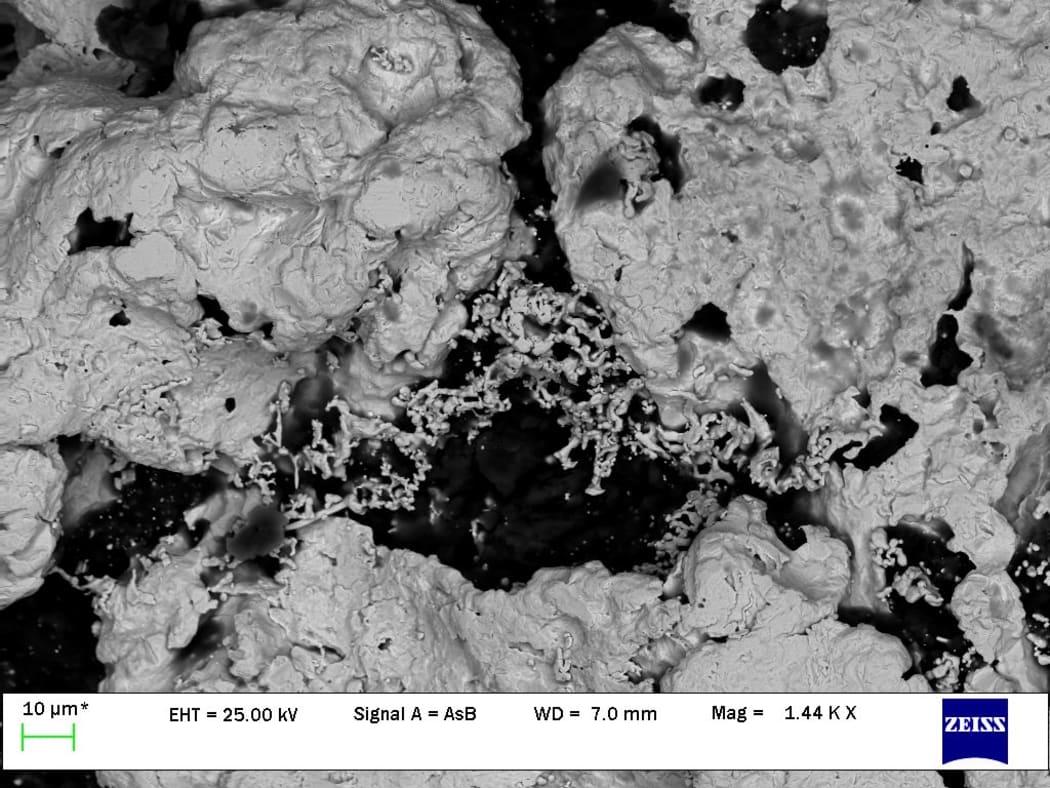A tiny piece of gold photographed under a scanning electron microscope - there are tiny worm cast-like structures in the centre