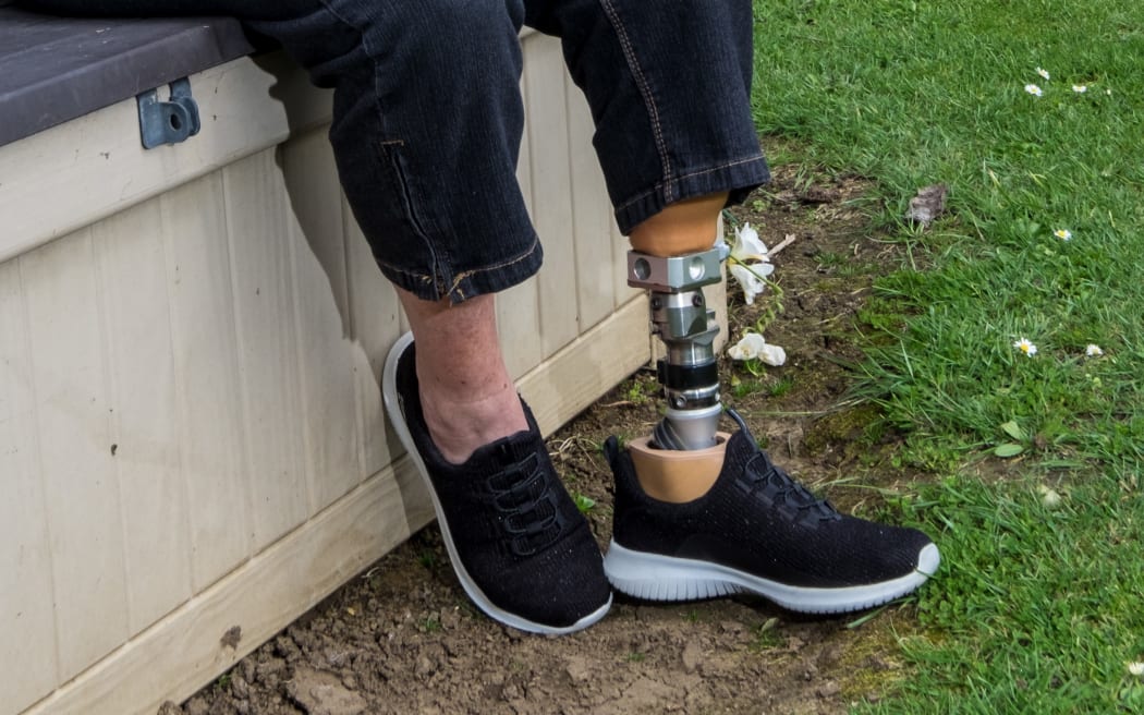 Diane Smith is an amputee that has had issues with the ACC prosthetics provider.