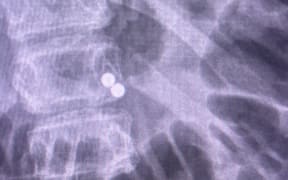 An X-ray of the magnets.
