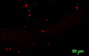 Microplastics visible after the application of dye. The scale is 50 microns, or 0.05 of a millimetre.