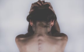 Women's bodies are highly political.