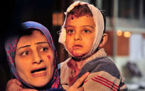 Wounded Syrian at a hospital in the Syrian capital Damascus folling bomb blasts.