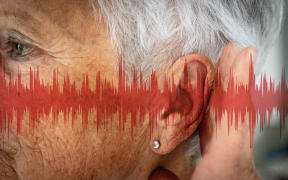 Close-up of the ear of a woman, with graphics representing sound waves 
 

GARO/PHANIE (Photo by GARO / Phanie / Phanie via AFP)
