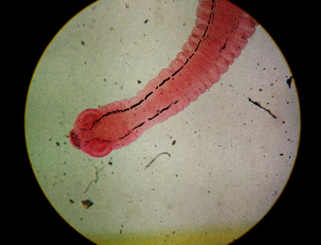 Close-up egg with adult parasite found with microscope in parasitology.