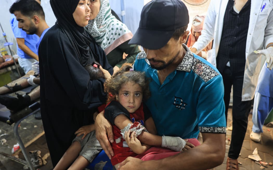 A wounded Palestinian girl is brought to be treated at the al-Awda Hospital in Nuseirat refugee camp after the Israeli military bombardment of the UNRWA (United Nations Relief and Works Agency for Palestine Refugees) run Abu Oreiban, turned shelter, where internally displaced Palestinians are living, in the Nuseirat camp, in the central Gaza Strip on July 14, 2024, amid the ongoing conflict between Israel and the Palestinian Hamas militant group.