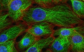 Human Breast Cancer Cells