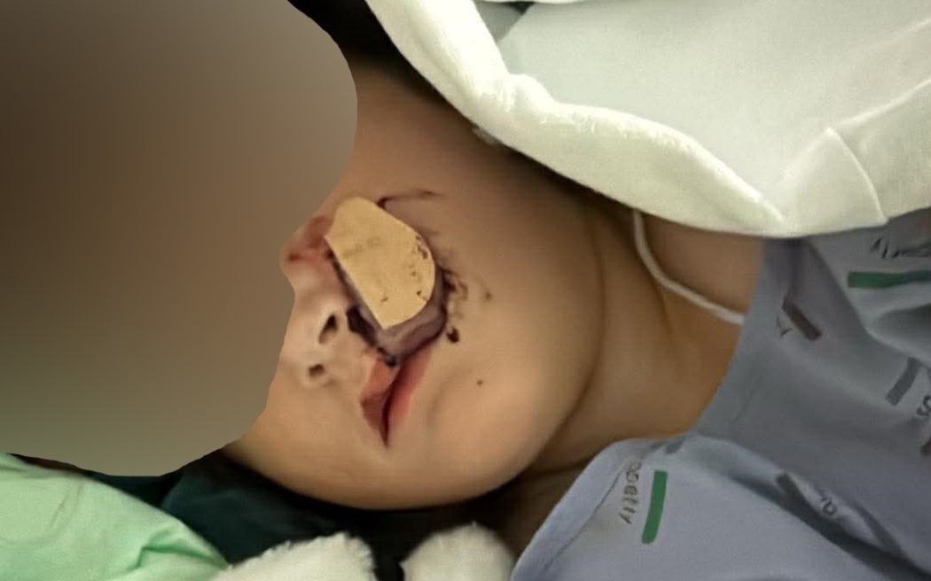 Dog attack - child victim blurred - 3 March 2026