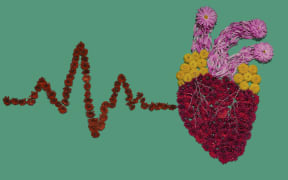 Heart health, conceptual image. (Photo by PEAKSTOCK / SCIENCE PHOTO LIBRAR / LDA / Science Photo Library via AFP)