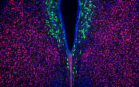 Researchers showed that while the number of oxytocinergic cells (green) are reduced in the brains of maternal high-fat diet offspring, treatment with Lactobacillus reuteri increases their number.