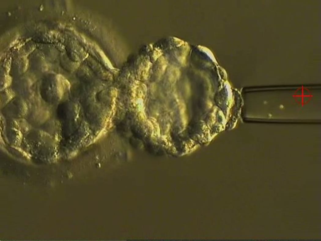 A human embryo at about six days old undergoing pre-implantation genetic testing to determine if it has too many chromosomes.