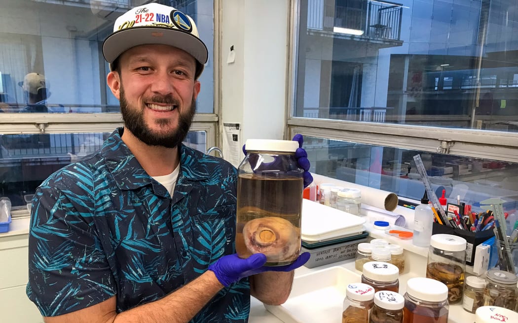 A man wearing a Hawaiian shirt and a cap holds a large jar with brown-ish translucent liquid and a fist-sized squid eye inside it.