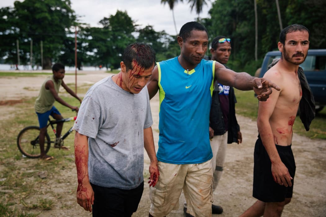 Australia was on August 15 facing growing opposition demands for an inquiry into its treatment of asylum-seekers on remote Pacific islands after further allegations emerged of abuse against refugees.