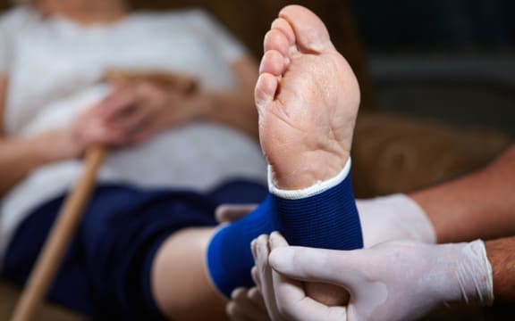 A woman with a broken or sprained foot having her leg bandaged.