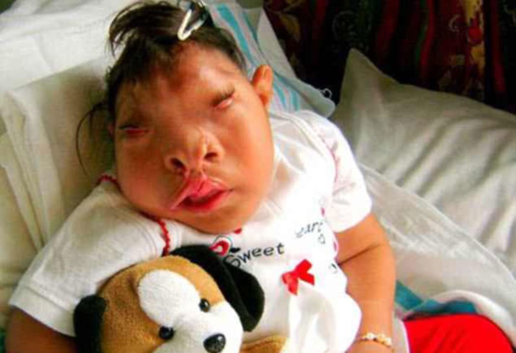 Baby miracle clearance