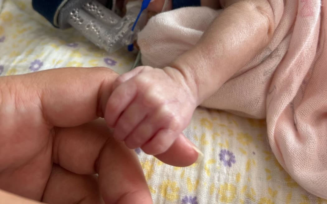 Mana underwent intensive care for months following her premature birth.